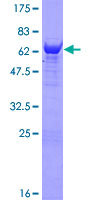 NANS Protein - 12.5% SDS-PAGE of human NANS stained with Coomassie Blue