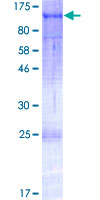 NAP1 / TAB3 Protein - 12.5% SDS-PAGE of human MAP3K7IP3 stained with Coomassie Blue