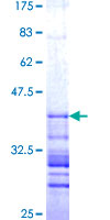 NAP1 / TAB3 Protein - 12.5% SDS-PAGE Stained with Coomassie Blue.
