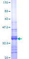 NAP1L1 Protein - 12.5% SDS-PAGE Stained with Coomassie Blue.