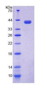 NAP1L1 Protein - Recombinant  Nucleosome Assembly Protein 1 Like Protein 1 By SDS-PAGE