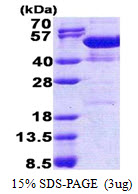 NAP1L4 Protein