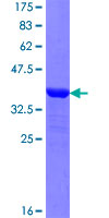 NAPG Protein - 12.5% SDS-PAGE Stained with Coomassie Blue.