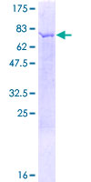 NAPRT Protein - 12.5% SDS-PAGE of human NAPRT1 stained with Coomassie Blue