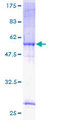 NAR / CPSF4 Protein - 12.5% SDS-PAGE of human CPSF4 stained with Coomassie Blue