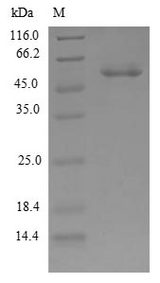 NAR / CPSF4 Protein - (Tris-Glycine gel) Discontinuous SDS-PAGE (reduced) with 5% enrichment gel and 15% separation gel.