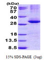 NAR / CPSF4 Protein