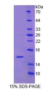 NARF Protein - Recombinant Nuclear Prelamin A Recognition Factor (NARF) by SDS-PAGE