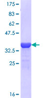 NARG1 / NAA15 Protein - 12.5% SDS-PAGE Stained with Coomassie Blue.