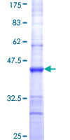 NARS Protein - 12.5% SDS-PAGE Stained with Coomassie Blue.