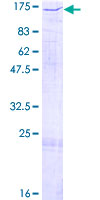NASP Protein - 12.5% SDS-PAGE of human NASP stained with Coomassie Blue