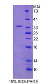 NASP Protein - Recombinant Nuclear Autoantigenic Sperm Protein, Histone Binding (NASP) by SDS-PAGE