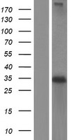 NAT1 / AAC1 Protein - Western validation with an anti-DDK antibody * L: Control HEK293 lysate R: Over-expression lysate
