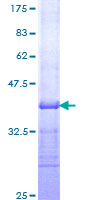 NAT1 / AAC1 Protein - 12.5% SDS-PAGE Stained with Coomassie Blue.