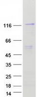 NAT10 Protein - Purified recombinant protein NAT10 was analyzed by SDS-PAGE gel and Coomassie Blue Staining