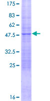 NAT14 Protein - 12.5% SDS-PAGE of human KLP1 stained with Coomassie Blue