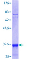 NAT14 Protein - 12.5% SDS-PAGE Stained with Coomassie Blue.