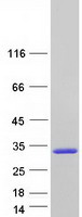 NAT15 Protein - Purified recombinant protein NAA60 was analyzed by SDS-PAGE gel and Coomassie Blue Staining