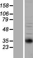 NAT2 Protein - Western validation with an anti-DDK antibody * L: Control HEK293 lysate R: Over-expression lysate