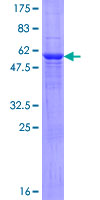 NAT2 Protein - 12.5% SDS-PAGE of human NAT2 stained with Coomassie Blue