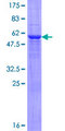 NAT2 Protein - 12.5% SDS-PAGE of human NAT2 stained with Coomassie Blue