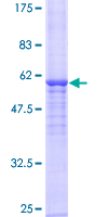 NAT2 Protein - 12.5% SDS-PAGE of human NAT2 stained with Coomassie Blue