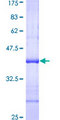 NAT2 Protein - 12.5% SDS-PAGE Stained with Coomassie Blue.