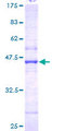 NAT5 / NAA20 Protein - 12.5% SDS-PAGE of human NAT5 stained with Coomassie Blue
