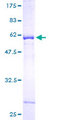 NAT6 / FUS2 Protein - 12.5% SDS-PAGE of human NAT6 stained with Coomassie Blue