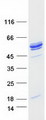 NAT6 / FUS2 Protein - Purified recombinant protein NAT6 was analyzed by SDS-PAGE gel and Coomassie Blue Staining