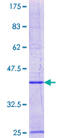 NAT8B Protein - 12.5% SDS-PAGE Stained with Coomassie Blue.