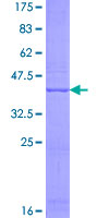 NAT8L Protein - 12.5% SDS-PAGE of human FLJ37478 stained with Coomassie Blue