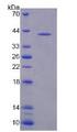 NAT8L Protein - Recombinant N-Acetyltransferase 8 Like Protein By SDS-PAGE