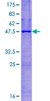 NATO3 / FERD3L Protein - 12.5% SDS-PAGE of human FERD3L stained with Coomassie Blue