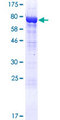 NAV1 Protein - 12.5% SDS-PAGE of human NAV1 stained with Coomassie Blue