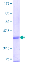 NAV2 Protein - 12.5% SDS-PAGE Stained with Coomassie Blue.