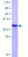 NBEA / Neurobeachin Protein - 12.5% SDS-PAGE Stained with Coomassie Blue.