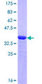 NBEA / Neurobeachin Protein - 12.5% SDS-PAGE Stained with Coomassie Blue.