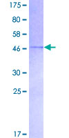 NBL1 / DAN Protein - 12.5% SDS-PAGE of human NBL1 stained with Coomassie Blue