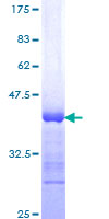 NBL1 / DAN Protein - 12.5% SDS-PAGE Stained with Coomassie Blue.