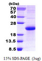 NBL1 / DAN Protein