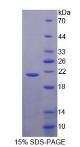 NBL1 / DAN Protein - Recombinant Neuroblastoma, Suppression Of Tumorigenicity 1 By SDS-PAGE