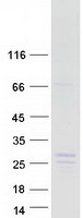 NBL1 / DAN Protein - Purified recombinant protein NBL1 was analyzed by SDS-PAGE gel and Coomassie Blue Staining