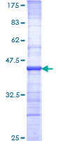 NBN / Nibrin Protein - 12.5% SDS-PAGE Stained with Coomassie Blue.