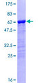 NBP / NUBP1 Protein - 12.5% SDS-PAGE of human NUBP1 stained with Coomassie Blue