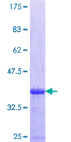 NBP / NUBP1 Protein - 12.5% SDS-PAGE Stained with Coomassie Blue.