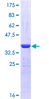 NBR1 Protein - 12.5% SDS-PAGE Stained with Coomassie Blue.