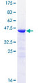 NCALD / Neurocalcin Delta Protein - 12.5% SDS-PAGE of human NCALD stained with Coomassie Blue