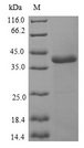 NCALD / Neurocalcin Delta Protein - (Tris-Glycine gel) Discontinuous SDS-PAGE (reduced) with 5% enrichment gel and 15% separation gel.