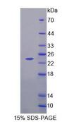 NCALD / Neurocalcin Delta Protein - Recombinant Neurocalcin Delta (NCALd) by SDS-PAGE